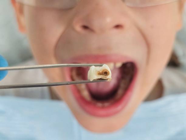 Best Weekend Emergency Dentist in Benton, LA