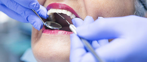 Best Emergency Treatment for Dental Infections or Abscesses in Benton, LA